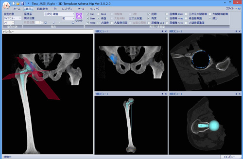 MRIやＣＴの画像データを３Ｄ表示